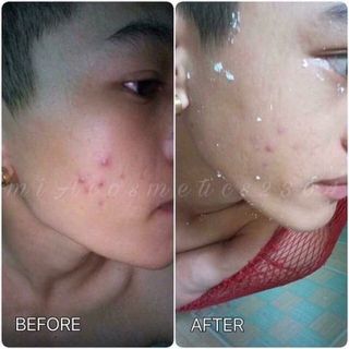 MASK dẻo bạc hà trà xanh