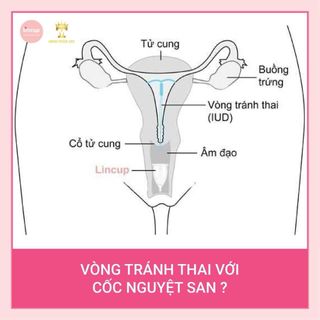 Cốc nguyệt san Lincup của Mĩ