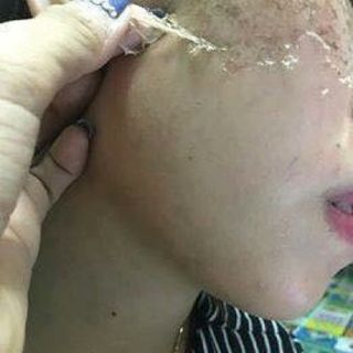 PEEL PERFECT - Tái tạo da