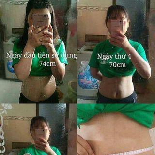 kem tan mỡ