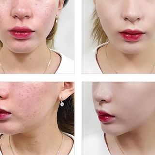 kem nền cellio collagen blemish balm bb