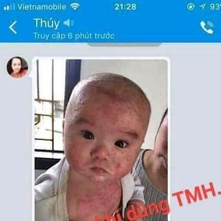 Thảo mộc trị các bệnh ngoài da Thanh Mộc Hương