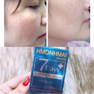 Kem Trị Nám 7 days