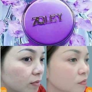 Kem Face Zoley Tím-Thần Dược trị Nám