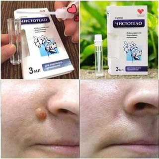 thuốc đặc trị mụn cơm mụn thịt