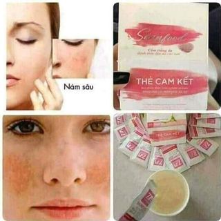 Cốm đẹp da ZN