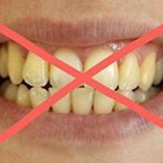 RẺ VÔ ĐỊCH Than Hoạt Tính Trắng Răng An Toàn Hiệu Quả Tại Nhà