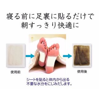 Miếng Dán Chân Khử Độc Tố Kenko Nhật Bản Hộp 30 Miếng