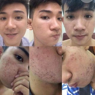 Trịmụn Sắc mộc thiên