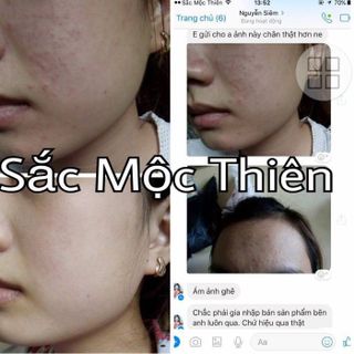 Trịmụn Sắc mộc thiên