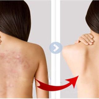 Soap muối khoáng trị mụn lưng bệnh về da Seacret