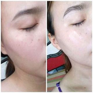 ủ FACE HEGONGMặt Nạ dưỡng da Hàn Quốc