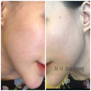 ủ Face Hegong mặt nạ dưỡng trắng