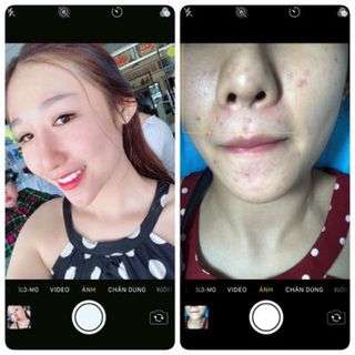 Combo Serum Face Mỡ Trăn Đông Y
