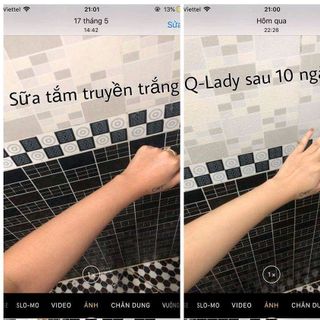 truyền trắng Q- Lady