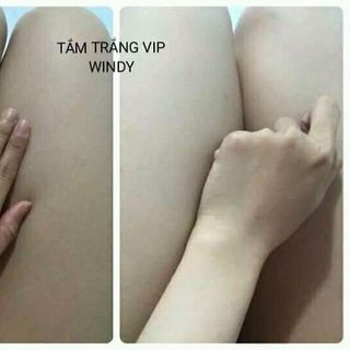 tắm trắng Windy 40k/gói