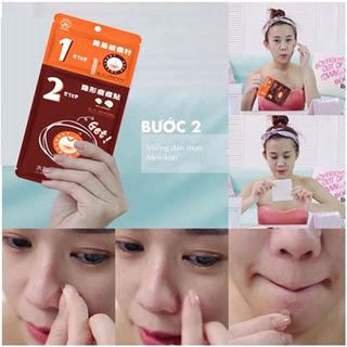 miếng dán mụn nhập khẩu hàng hót