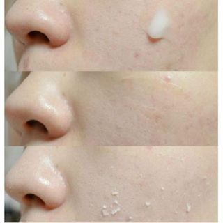 Tẩy da chết Rosette