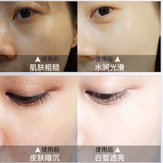 Kem che khuyết điểm ngọc trai Noble Lady