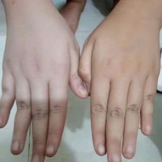 Ủ trắng ONatural
