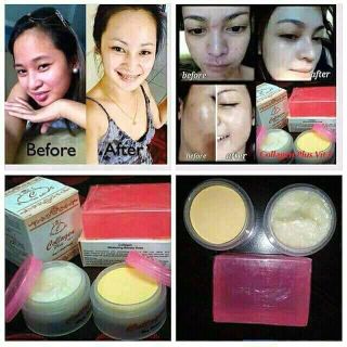 Tặng 3 HĐBHSỈ 5 SET KEMSOAP COLLAGEN PLUS VIT E