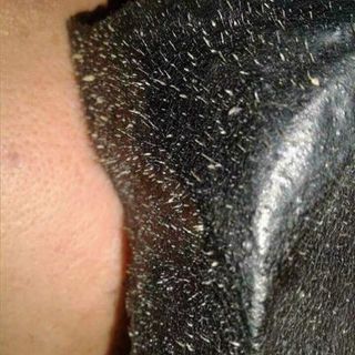 Gel Lột Mụn Lê Thanh