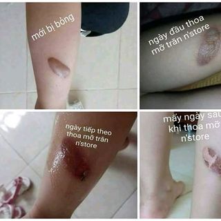 Mỡ trăn nguyên chất nstore