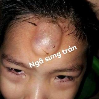 bách nhi tán đa công dụng