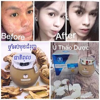 ủ thảo dược