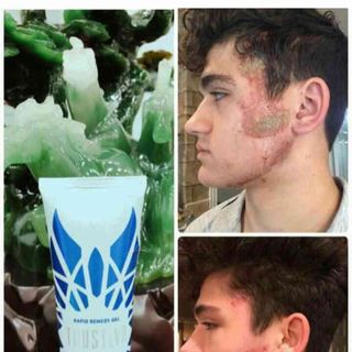 Thục phẫm chức năng