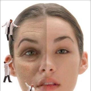 kem trị nám Tàn Nhang DARK SPOT ERASER