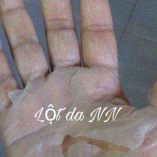 thay da body