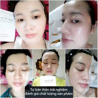 Mặt nạ thai nhau cừu