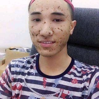 Mặt nạ thải mụn
