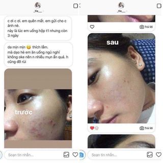 20dayskin