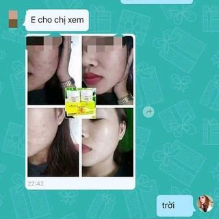 Bộ sản phẩm trị mụn mocha