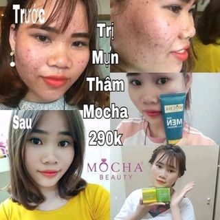 Bộ sản phẩm trị mụn mocha