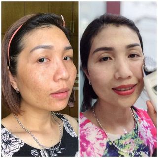 máy nâng cơ Ageloc Gavanicspa