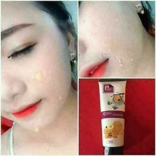 tẩy tế bào chết