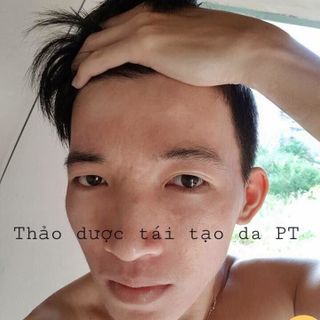 THẢO DƯỢC THIÊN NHIÊN TÁI TẠO DA HOA MỘC LAN