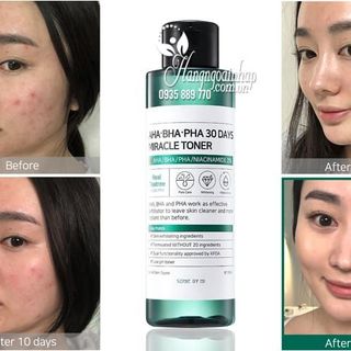 Nước hoa hồng trị mụn AHA BHA PHA 30 Days Miracle Toner 150ml