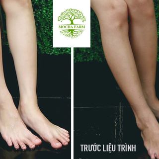Truyền trắng sữa trà 8D