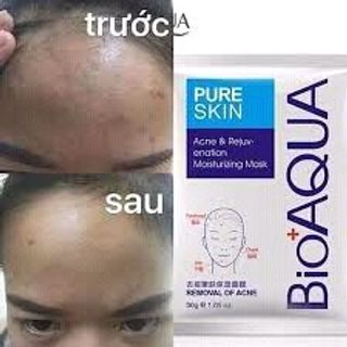 Mặt nạ bạc trị mụn đỏ mask Pure Skin Bioaqua