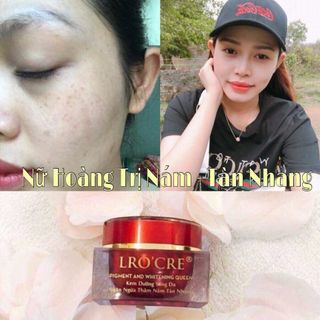 kem đặc trị nám tàn nhang lrocre