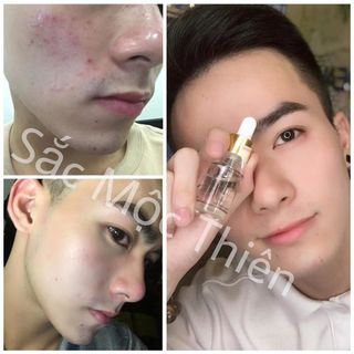 Bạch thiên thảo - sắc mộc thiên