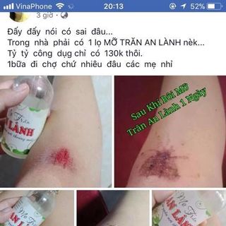 Bộ triệt lông mỡ trăn tặng dụng cụ Wax
