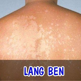 Thuốc đặc trị ngoài da thanh mộc hương