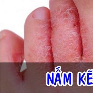 Thuốc đặc trị ngoài da thanh mộc hương
