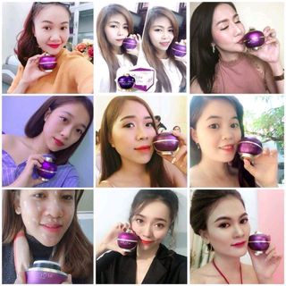 KEM FACE VIP TUYẾT SỮA
