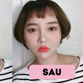 Miếng dán mặt Vline